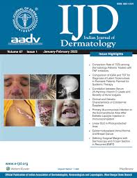 Indian Journal Of Dermatology Indian Journal Of Dermatology